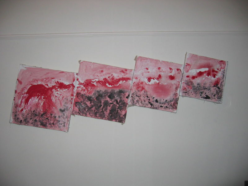 Brain Haemorrhage