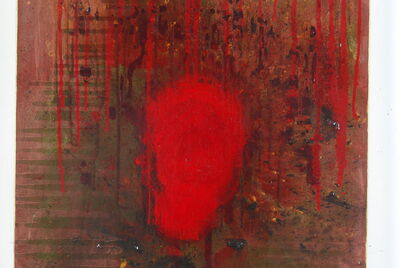 Thrombus ( detail  