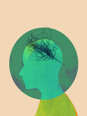 Epilepsy II