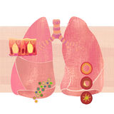 Bronchitis (book cover artwork)